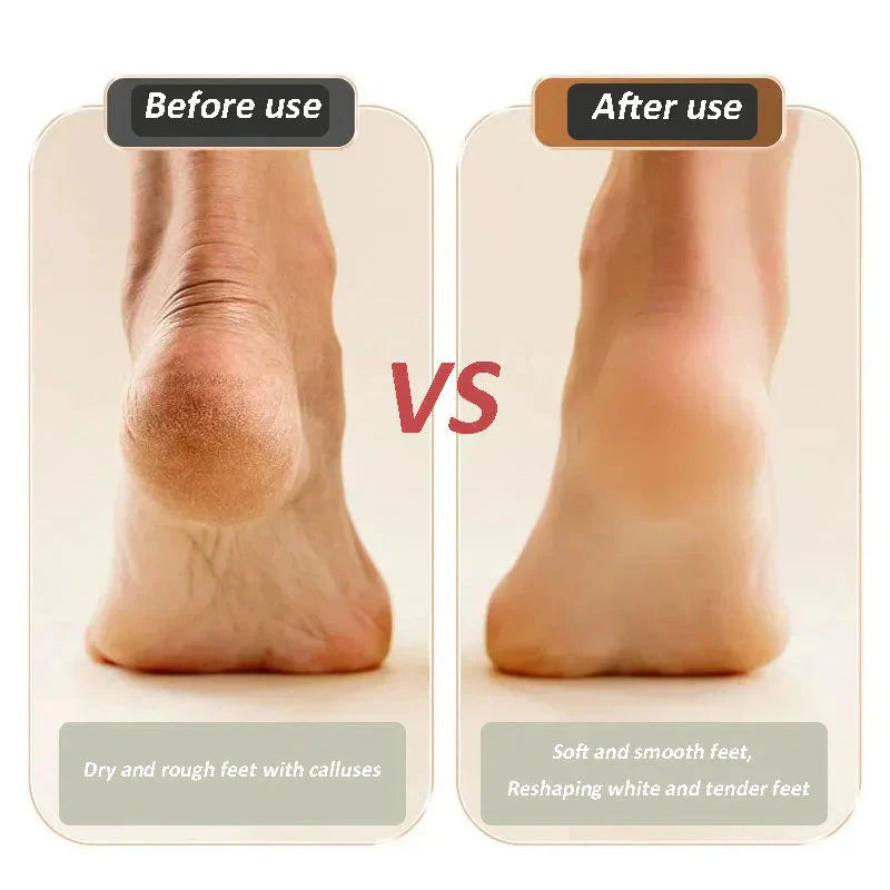 ✨👣2025 Neues USB-Ladegerät für Fußreparaturen und Schleifen