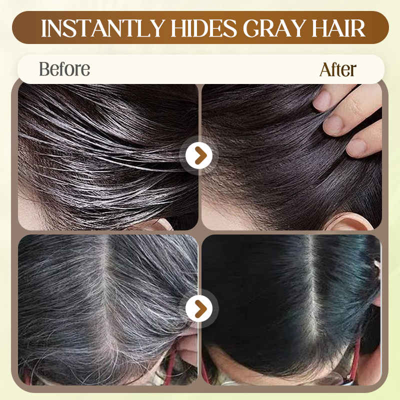 🎅Weihnachts-Sonderangebot: 50 % Rabatt🎁Sofortige graue Haare Abdeckung Kamm