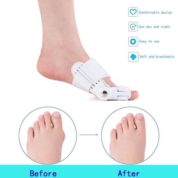 🔥kuuma SALE- 【Lääkäri suosittelee】. Bunion Corrector miehille ja naisille